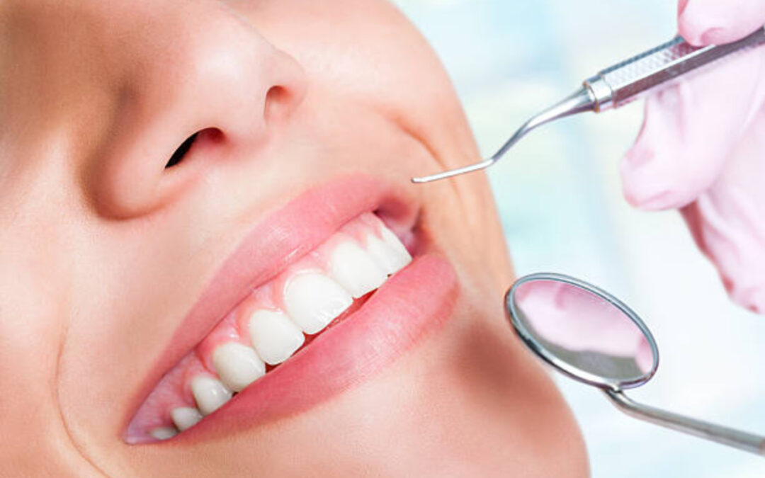 Co to jest bonding zębów i kiedy warto go wykonać?